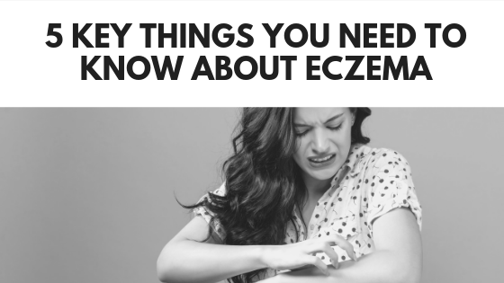 5 Key Things You Need to Know About Eczema