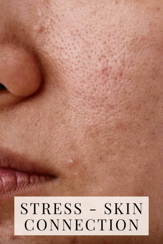 picture of woman with a few spots on her face