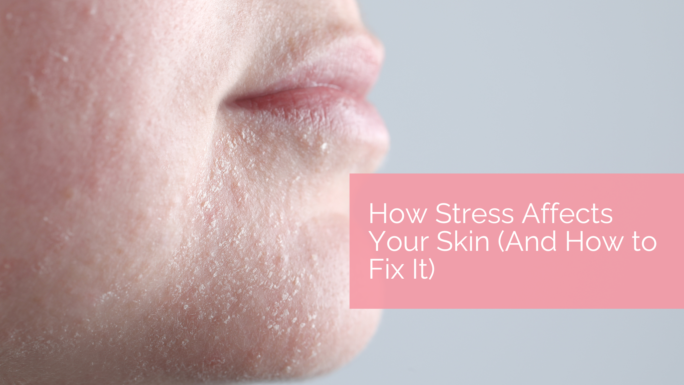 Effects of Stress on Your Skin and What You Can Do About It
