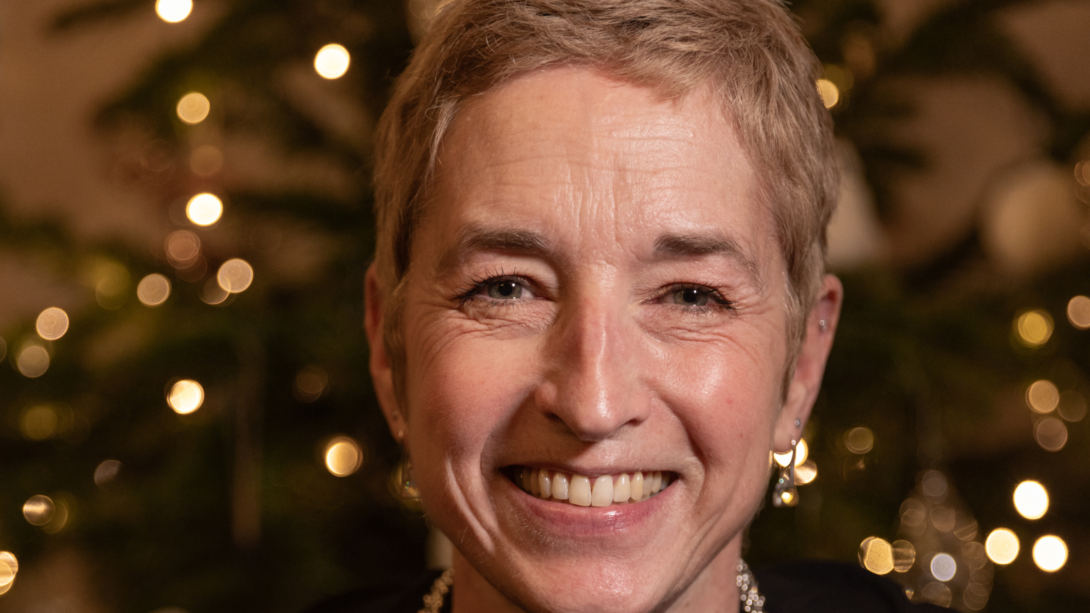 Gemma, founder of Puremess Skincare talking about the effects of tamoxifen on your skin