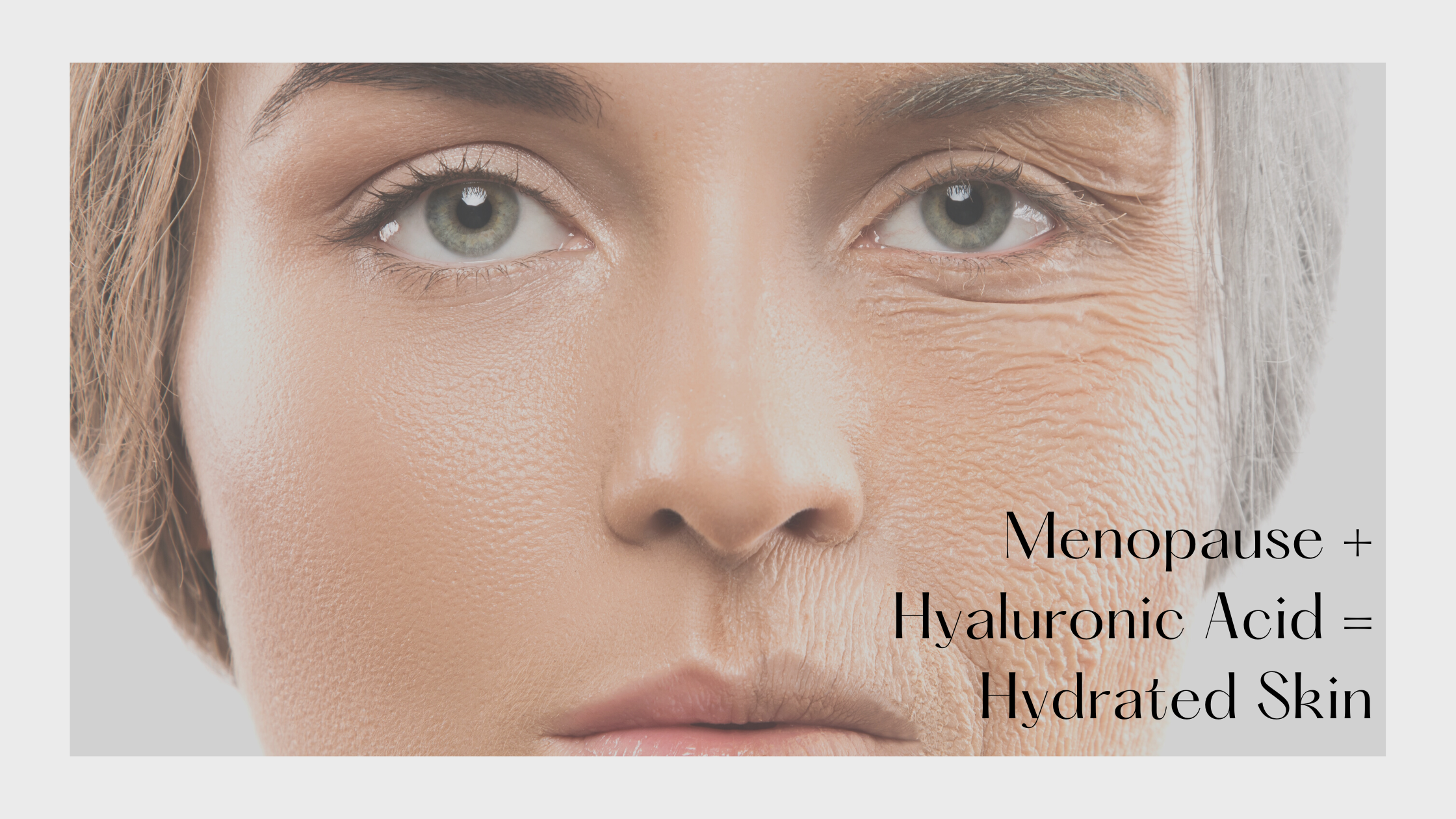 Menopause + Hyaluronic Acid = Hydrated Skin