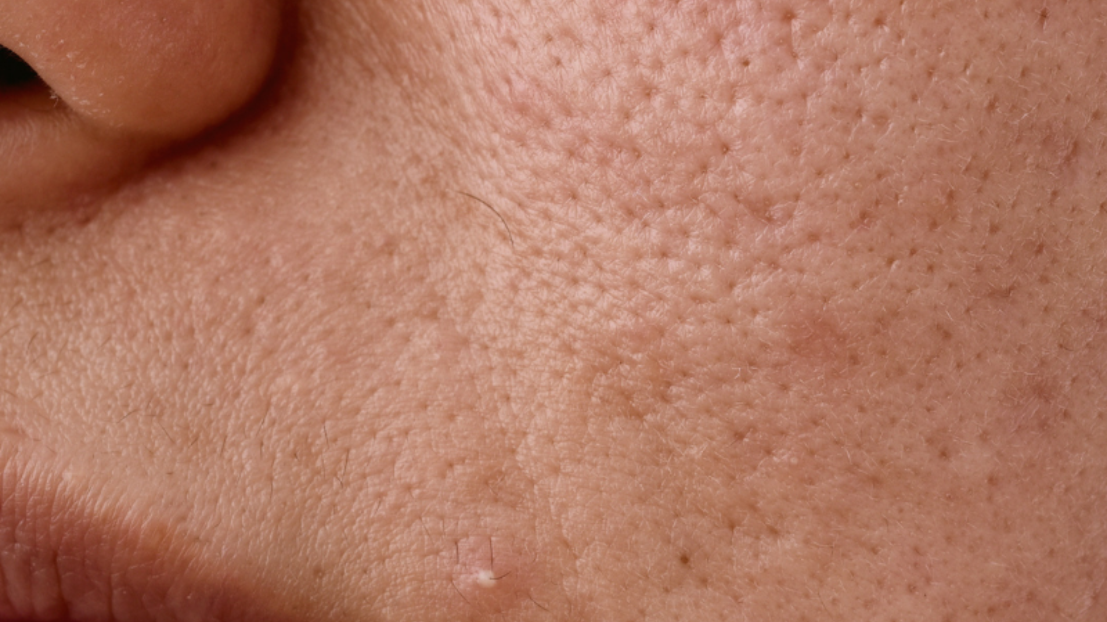 close up of stressed skin showing a few spots and enlarged pores